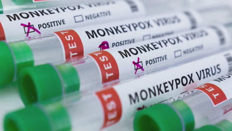 With monkeypox cases on the rise, how safe are day-to-day activities?